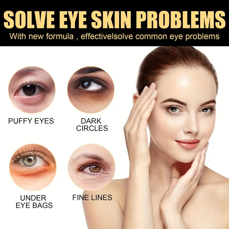 4 in 1 Magic Eye Cream ( Removes the Eye Bags - Anti Wrinkle - Lifting the Skin - Moisturizer ) - My Secretss
